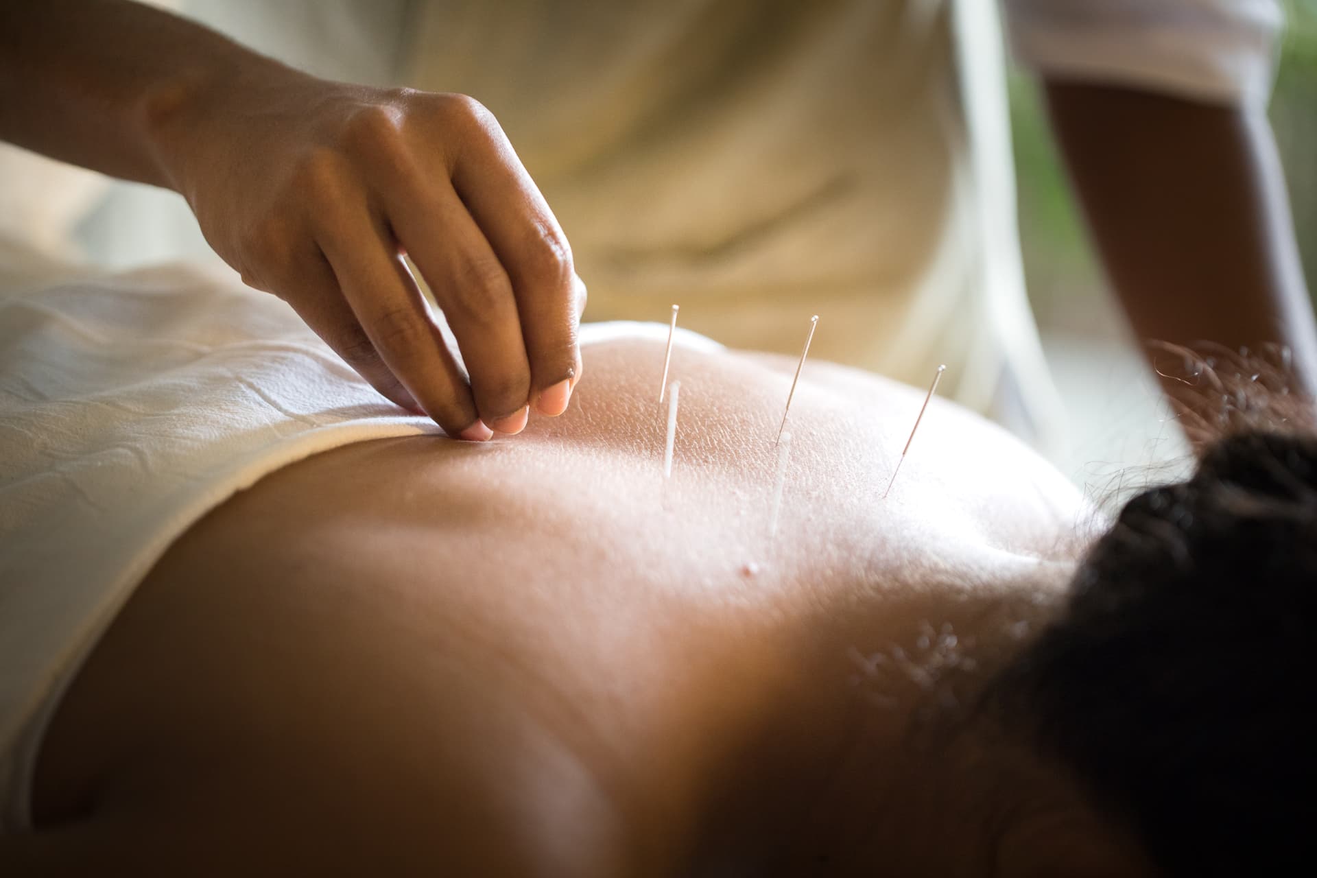 Prakriti Shakti, CGH Earth — acupuncture session